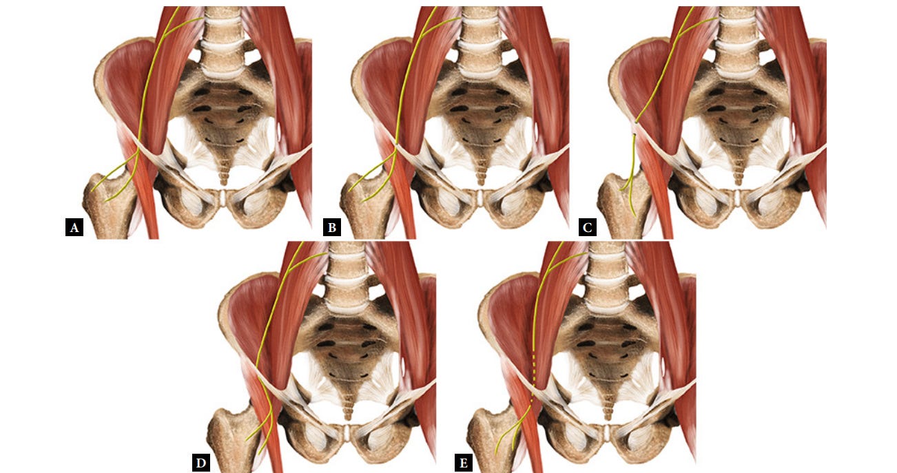 Meralgia parestesica tempo formacion ecografia 1.jpg